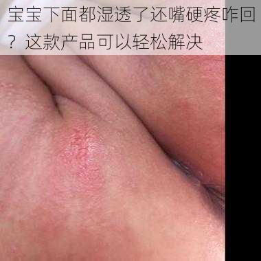 宝宝下面都湿透了还嘴硬疼咋回？这款产品可以轻松解决