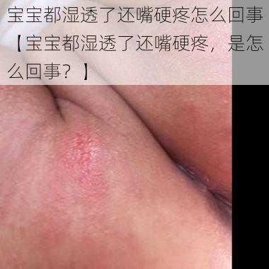 宝宝都湿透了还嘴硬疼怎么回事【宝宝都湿透了还嘴硬疼，是怎么回事？】