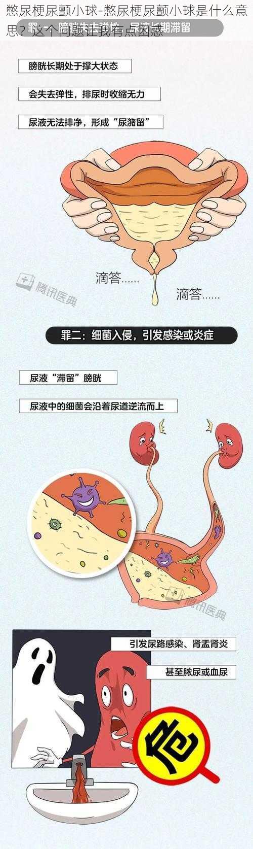 憋尿梗尿颤小球-憋尿梗尿颤小球是什么意思？这个问题让我有点困惑