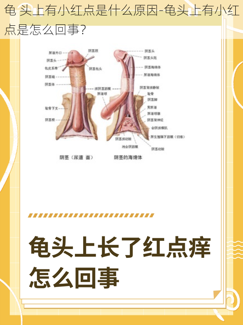 龟 头上有小红点是什么原因-龟头上有小红点是怎么回事？