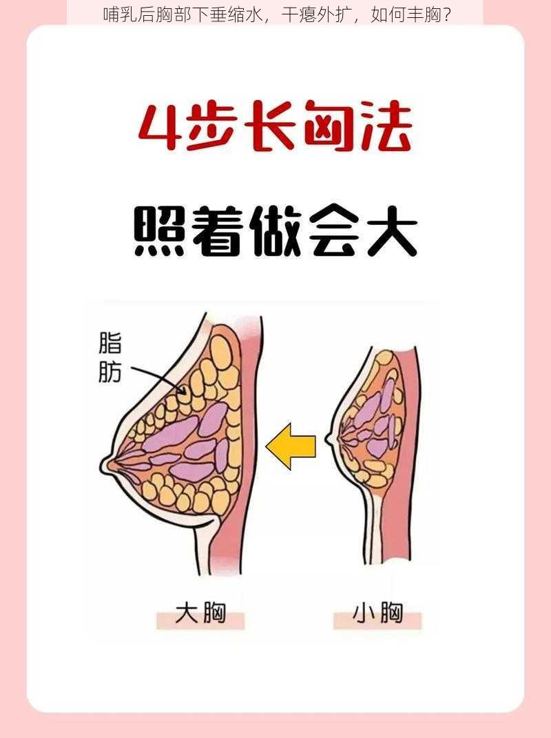 哺乳后胸部下垂缩水，干瘪外扩，如何丰胸？